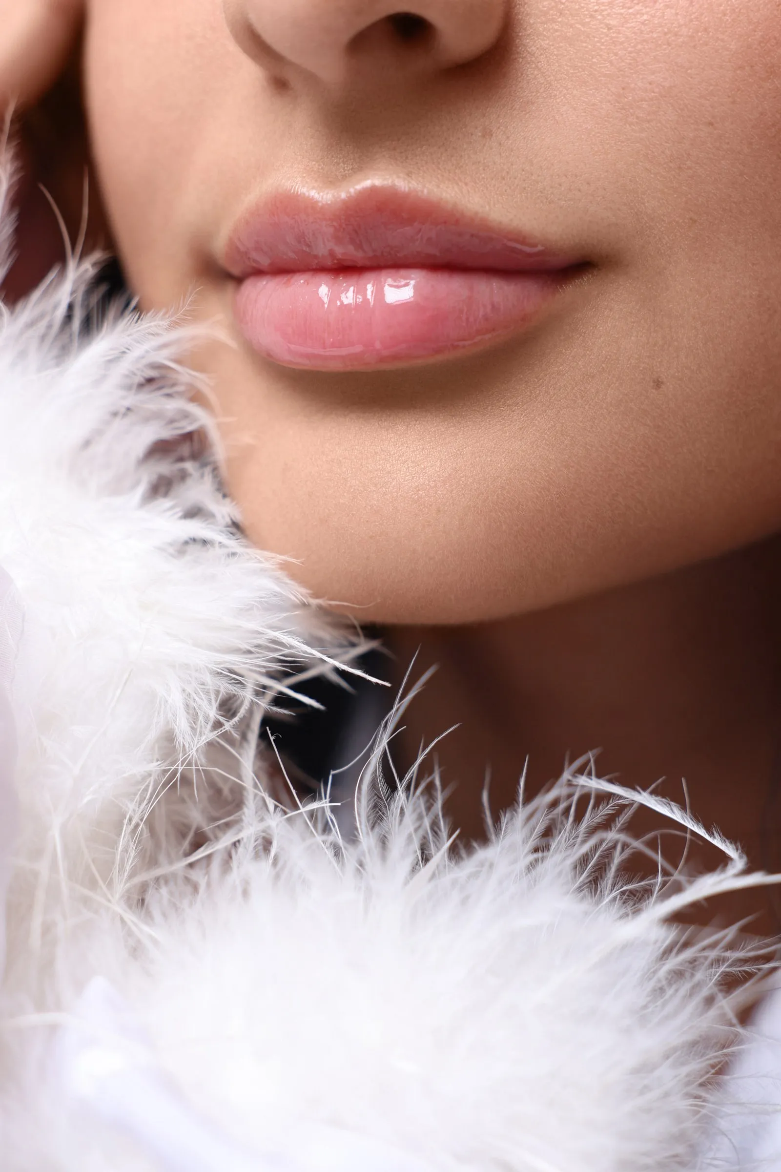Real Lip Filler result at Dermabless Med Spa Miami, photo 3