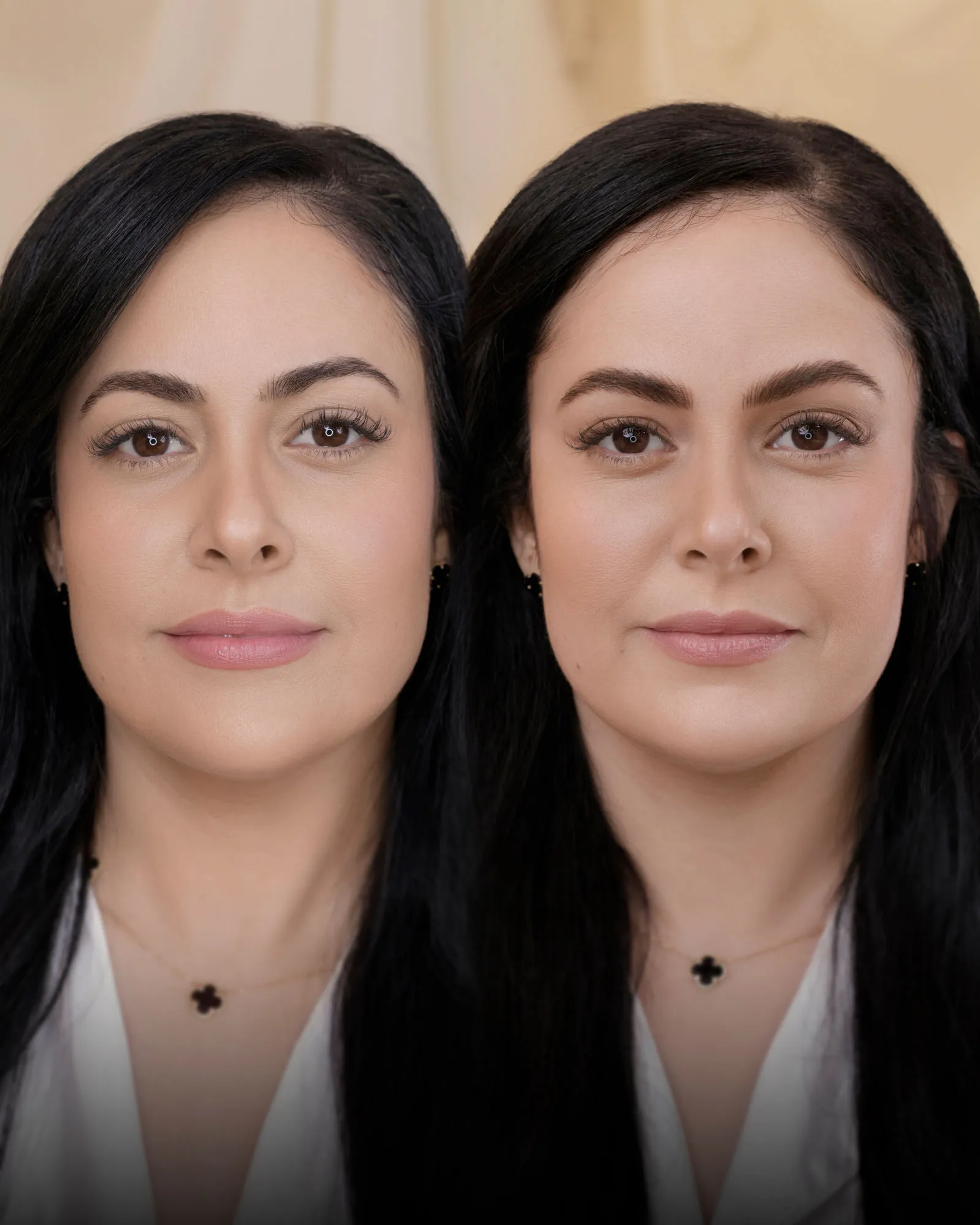 Hyperrealistic Nano Strokes brows by Mily Ajo at Dermabless, photo 9