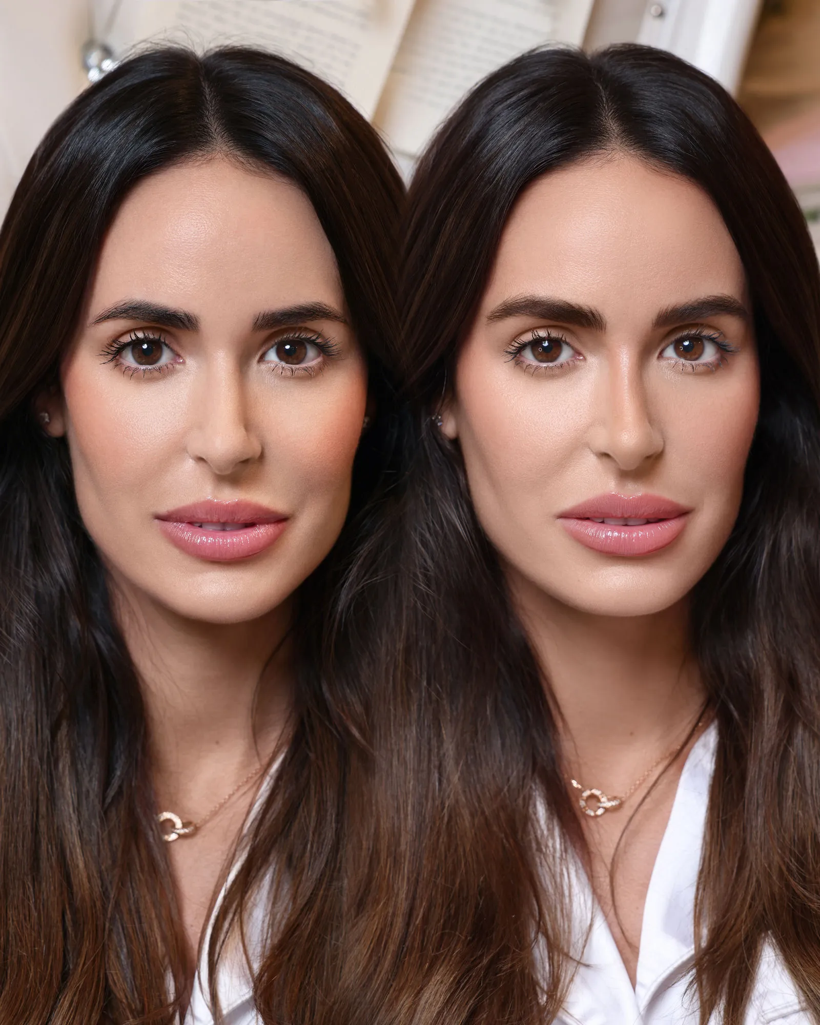 Hyperrealistic nano strokes eyebrow micropigmentation result at Dermabless Miami.